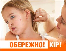 Що варто знати про кір